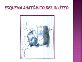 Aplicación del sulfato de magnesio - Enfermeria