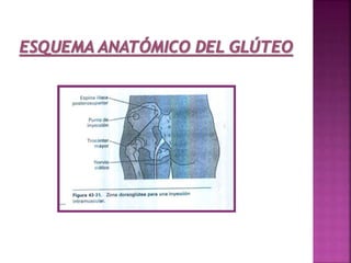 Aplicación del sulfato de magnesio - Enfermeria