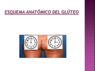 Aplicación del sulfato de magnesio - Enfermeria