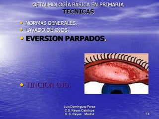 Traumatismos y urgencias oftalmólogicas