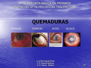 Traumatismos y urgencias oftalmólogicas