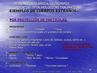 Traumatismos y urgencias oftalmólogicas