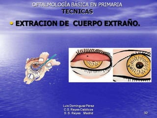 Traumatismos y urgencias oftalmólogicas