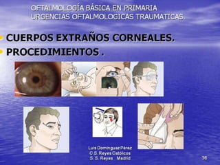 Traumatismos y urgencias oftalmólogicas