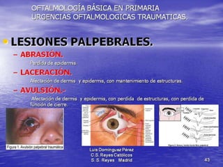 Traumatismos y urgencias oftalmólogicas
