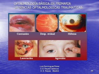 Traumatismos y urgencias oftalmólogicas