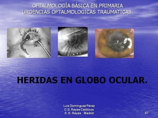 Traumatismos y urgencias oftalmólogicas