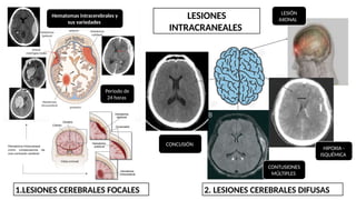 1.LESIONES CEREBRALES FOCALES 2. LESIONES CEREBRALES DIFUSAS
Hematomas intracerebrales y
sus variedades
Periodo de
24 horas
LESIONES
INTRACRANEALES
CONCUSIÓN
CONTUSIONES
MÚLTIPLES
HIPOXIA -
ISQUÉMICA
LESIÓN
AXONAL
 