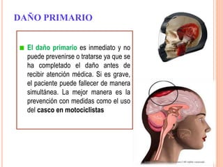 DAÑO PRIMARIO
El daño primario es inmediato y no
puede prevenirse o tratarse ya que se
ha completado el daño antes de
recibir atención médica. Si es grave,
el paciente puede fallecer de manera
simultánea. La mejor manera es la
prevención con medidas como el uso
del casco en motociclistas
 