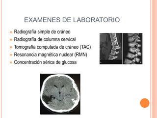 EXAMENES DE LABORATORIO
 Radiografía simple de cráneo
 Radiografía de columna cervical
 Tomografía computada de cráneo (TAC)
 Resonancia magnética nuclear (RMN)
 Concentración sérica de glucosa
 