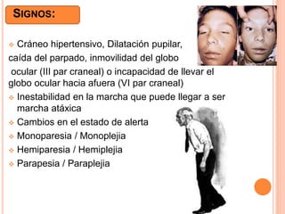 SIGNOS:
 Cráneo hipertensivo, Dilatación pupilar,
caída del parpado, inmovilidad del globo
ocular (III par craneal) o incapacidad de llevar el
globo ocular hacia afuera (VI par craneal)
 Inestabilidad en la marcha que puede llegar a ser
marcha atáxica
 Cambios en el estado de alerta
 Monoparesia / Monoplejia
 Hemiparesia / Hemiplejia
 Parapesia / Paraplejia
 