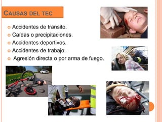 CAUSAS DEL TEC
 Accidentes de transito.
 Caídas o precipitaciones.
 Accidentes deportivos.
 Accidentes de trabajo.
 Agresión directa o por arma de fuego.
 