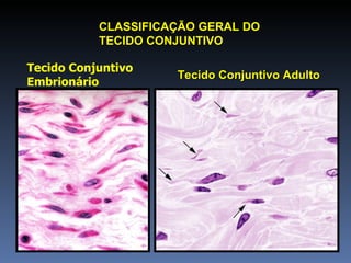Tecido Conjuntivo Embrionário CLASSIFICAÇÃO GERAL DO  TECIDO CONJUNTIVO Tecido Conjuntivo Adulto 