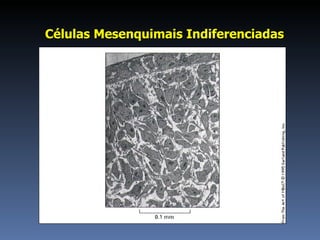 Células Mesenquimais Indiferenciadas 
