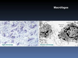 Macrófagos 
