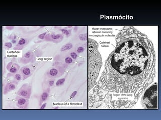 Plasmócito 