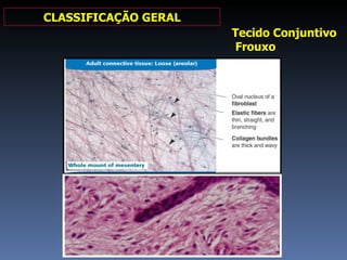 CLASSIFICAÇÃO GERAL Tecido Conjuntivo Frouxo 