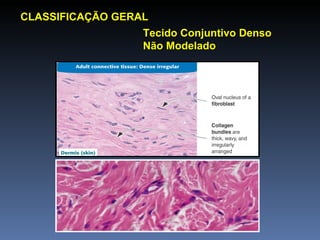 CLASSIFICAÇÃO GERAL Tecido Conjuntivo Denso Não Modelado 