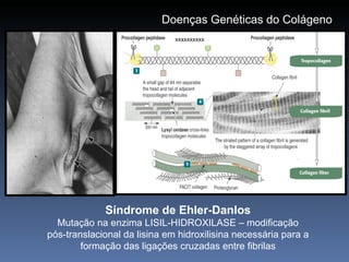 Doenças Genéticas do Colágeno Síndrome de Ehler-Danlos Mutação na enzima LISIL-HIDROXILASE – modificação pós-translacional da lisina em hidroxilisina necessária para a formação das ligações cruzadas entre fibrilas xxxxxxxxxx 