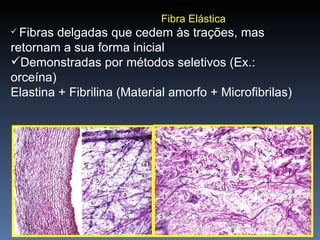 Fibra Elástica Fibras delgadas que cedem às trações, mas retornam a sua forma inicial Demonstradas por métodos seletivos (Ex.: orceína) Elastina + Fibrilina (Material amorfo + Microfibrilas) 