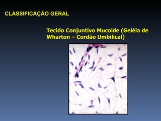 Tecido Conjuntivo Mucoide (Geléia de Wharton – Cordão Umbilical) CLASSIFICAÇÃO GERAL 