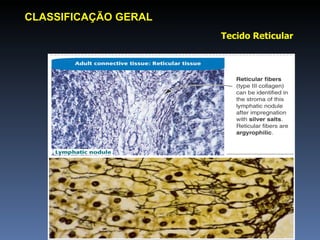 Tecido Reticular CLASSIFICAÇÃO GERAL 