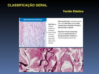 Tecido Elástico CLASSIFICAÇÃO GERAL 