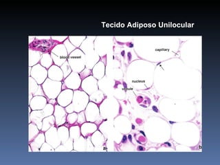 Tecido Adiposo Unilocular 