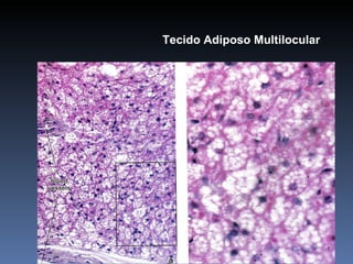 Tecido Adiposo Multilocular 