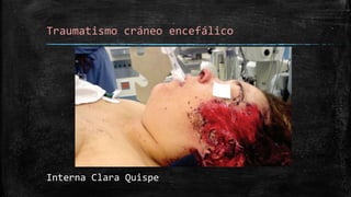 Traumatismo cráneo encefálico
Interna Clara Quispe
 