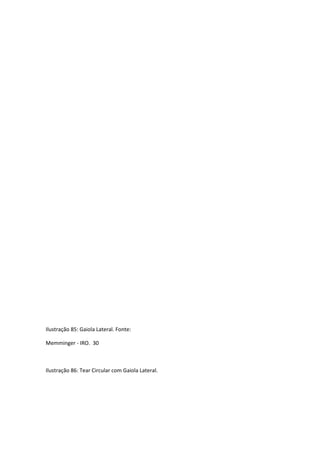 Ilustração 85: Gaiola Lateral. Fonte:
Memminger - IRO. 30
Ilustração 86: Tear Circular com Gaiola Lateral.
 
