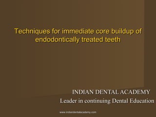 Techniques for immediate core buildup ofTechniques for immediate core buildup of
endodontically treated teethendodontically treated teeth
INDIAN DENTAL ACADEMYINDIAN DENTAL ACADEMY
Leader in continuing Dental EducationLeader in continuing Dental Education
www.indiandentalacademy.comwww.indiandentalacademy.com
 