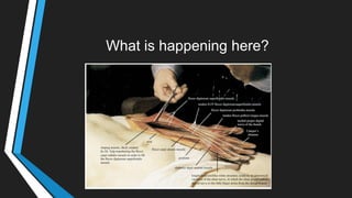 What is happening here?
 