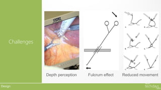 Challenges




                 Depth perception   Fulcrum effect   Reduced movement

Design
 