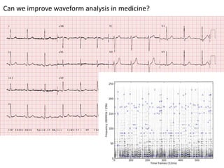 Can we improve waveform analysis in medicine?
 