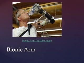 Bionic Arm YouTube Video
Bionic Arm
 