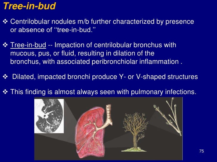 Technical aspect of hrct; normal lung anatomy & hrct findings of lung…