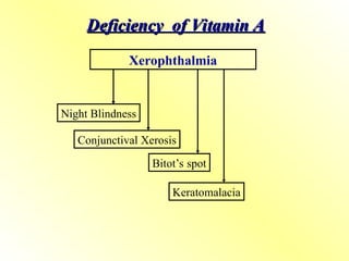 Deficiency of Vitamin A
Deficiency of Vitamin A
Night Blindness
Keratomalacia
Bitot’s spot
Conjunctival Xerosis
Xerophthalmia
 