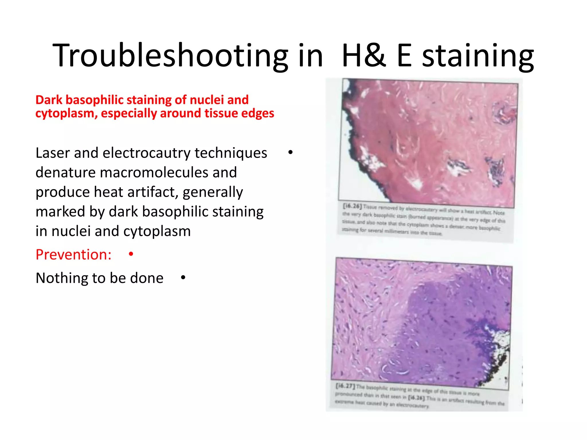 Technical Faults In Histopathology Lab Pptx
