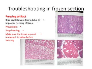 Troubleshooting in frozen section
Freezing artifact
If ice crystals were formed due to •
improper freezing of tissue.
Prevention: •
Snap freezing •
Make sure the tissue was not
•
immersed in saline before
freezing

 
