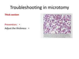 Troubleshooting in microtomy
Thick section

Prevention: •
Adjust the thickness •

 