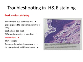 Troubleshooting in H& E staining
Dark nuclear staining
The nuclei is too dark due to : •
Slide exposed to the hematoxylin too
long
Section are too thick •
Differentiation step is too short •
Prevention: •
Thin sections •
Decrease hematoxylin exposure •
Increase time for differentiation •

 