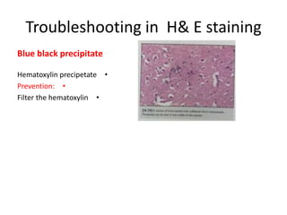 Troubleshooting in H& E staining
Blue black precipitate
Hematoxylin precipetate •
Prevention: •
Filter the hematoxylin •

 