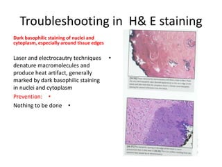 Troubleshooting in H& E staining
Dark basophilic staining of nuclei and
cytoplasm, especially around tissue edges

Laser and electrocautry techniques
denature macromolecules and
produce heat artifact, generally
marked by dark basophilic staining
in nuclei and cytoplasm
Prevention: •
Nothing to be done •

•

 