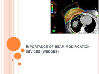 IMPORTANCE OF BEAM MODIFICATION
DEVICES (WEDGES)
 