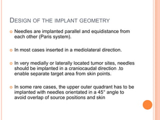 DESIGN OF THE IMPLANT GEOMETRY
 Needles are implanted parallel and equidistance from
each other (Paris system).
 In most cases inserted in a mediolateral direction.
 In very medially or laterally located tumor sites, needles
should be implanted in a craniocaudal direction .to
enable separate target area from skin points.
 In some rare cases, the upper outer quadrant has to be
implanted with needles orientated in a 45° angle to
avoid overlap of source positions and skin
 