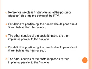  Reference needle is first implanted at the posterior
(deepest) side into the centre of the PTV.
 For definitive positioning, the needle should pass about
5 mm behind the internal scar.
 The other needles of the posterior plane are then
implanted parallel to the first one.
 For definitive positioning, the needle should pass about
5 mm behind the internal scar.
 The other needles of the posterior plane are then
implanted parallel to the first one.
 
