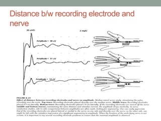 Distance b/w recording electrode and
nerve
 