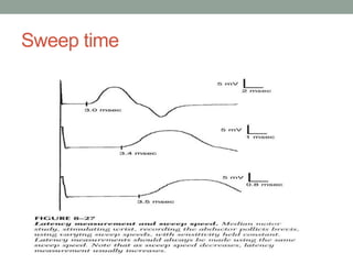 Sweep time
 