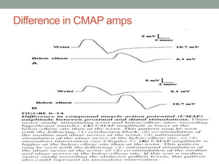Difference in CMAP amps
 